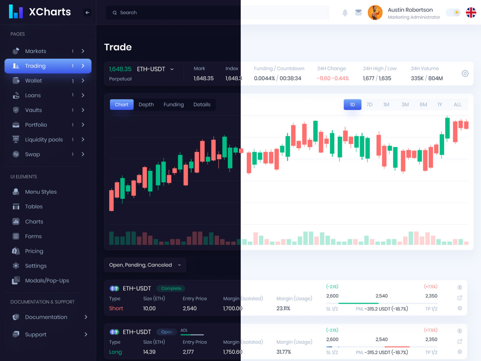 XCharts - Charts and Tables for Financial SaaS Dashboard